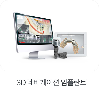 3D 네비게이션 임플란트