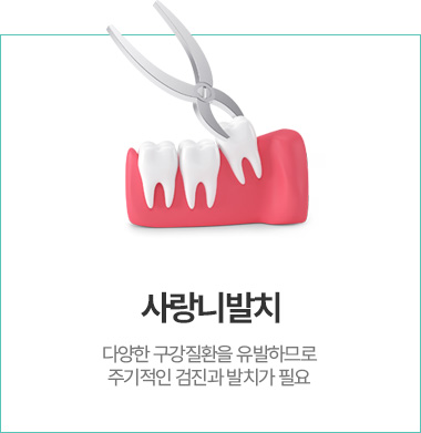 사랑니발치